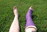 What to Do When an Injury Derails Your DIY Project