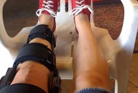 Preparing Your Home for Recovery After Knee Surgery