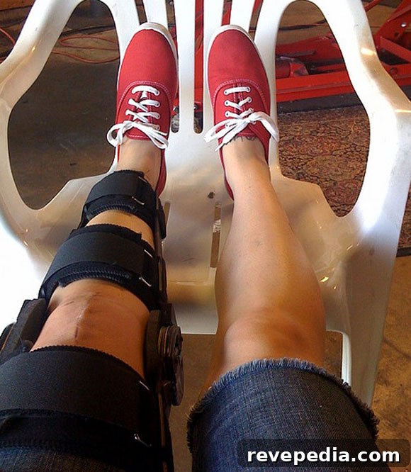 Preparing Your Home for Recovery After Knee Surgery 2 acl-knee-surgery-brace.jpg